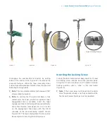 Preview for 33 page of Zimmer Biomet Arcos Modular FemoralRevision System Surgical Technique