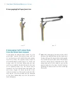 Preview for 34 page of Zimmer Biomet Arcos Modular FemoralRevision System Surgical Technique