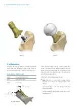 Предварительный просмотр 8 страницы Zimmer Biomet Avenir Complete Hip System Surgical Technique