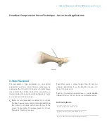 Предварительный просмотр 7 страницы Zimmer Biomet Headless Compressionand Twist-Off Screws Surgical Technique