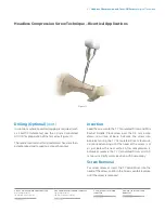 Предварительный просмотр 11 страницы Zimmer Biomet Headless Compressionand Twist-Off Screws Surgical Technique