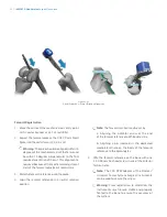 Preview for 14 page of Zimmer Biomet iASSIST Knee Manual