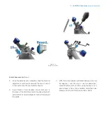 Preview for 17 page of Zimmer Biomet iASSIST Knee Manual