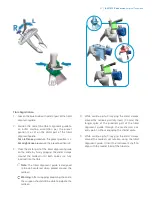 Preview for 23 page of Zimmer Biomet iASSIST Knee Manual