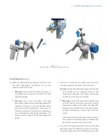 Preview for 25 page of Zimmer Biomet iASSIST Knee Manual