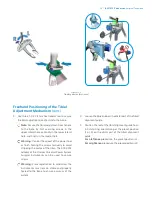 Preview for 35 page of Zimmer Biomet iASSIST Knee Manual