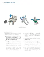 Preview for 40 page of Zimmer Biomet iASSIST Knee Manual