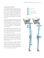 Preview for 7 page of Zimmer Biomet NexGen MIS LPS-Flex Surgical Technique Manual