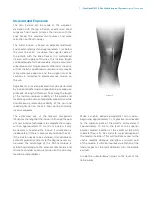 Preview for 9 page of Zimmer Biomet NexGen MIS LPS-Flex Surgical Technique Manual