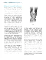 Preview for 10 page of Zimmer Biomet NexGen MIS LPS-Flex Surgical Technique Manual