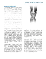 Preview for 11 page of Zimmer Biomet NexGen MIS LPS-Flex Surgical Technique Manual