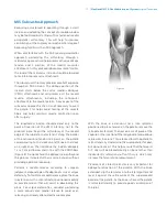 Preview for 13 page of Zimmer Biomet NexGen MIS LPS-Flex Surgical Technique Manual