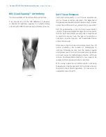 Preview for 14 page of Zimmer Biomet NexGen MIS LPS-Flex Surgical Technique Manual