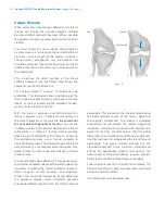 Preview for 16 page of Zimmer Biomet NexGen MIS LPS-Flex Surgical Technique Manual