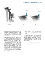 Preview for 19 page of Zimmer Biomet NexGen MIS LPS-Flex Surgical Technique Manual