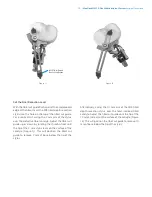 Preview for 21 page of Zimmer Biomet NexGen MIS LPS-Flex Surgical Technique Manual