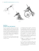 Preview for 24 page of Zimmer Biomet NexGen MIS LPS-Flex Surgical Technique Manual