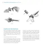 Preview for 26 page of Zimmer Biomet NexGen MIS LPS-Flex Surgical Technique Manual