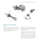 Preview for 27 page of Zimmer Biomet NexGen MIS LPS-Flex Surgical Technique Manual