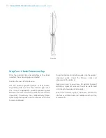 Preview for 28 page of Zimmer Biomet NexGen MIS LPS-Flex Surgical Technique Manual