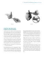 Preview for 29 page of Zimmer Biomet NexGen MIS LPS-Flex Surgical Technique Manual