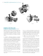 Preview for 30 page of Zimmer Biomet NexGen MIS LPS-Flex Surgical Technique Manual