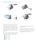 Preview for 36 page of Zimmer Biomet NexGen MIS LPS-Flex Surgical Technique Manual