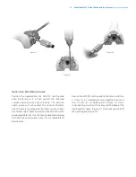 Preview for 41 page of Zimmer Biomet NexGen MIS LPS-Flex Surgical Technique Manual