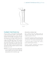 Preview for 43 page of Zimmer Biomet NexGen MIS LPS-Flex Surgical Technique Manual