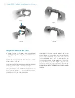 Preview for 44 page of Zimmer Biomet NexGen MIS LPS-Flex Surgical Technique Manual