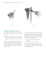 Preview for 46 page of Zimmer Biomet NexGen MIS LPS-Flex Surgical Technique Manual