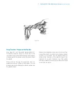 Preview for 53 page of Zimmer Biomet NexGen MIS LPS-Flex Surgical Technique Manual