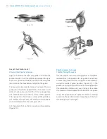 Preview for 56 page of Zimmer Biomet NexGen MIS LPS-Flex Surgical Technique Manual