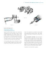 Preview for 57 page of Zimmer Biomet NexGen MIS LPS-Flex Surgical Technique Manual