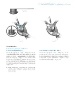 Preview for 59 page of Zimmer Biomet NexGen MIS LPS-Flex Surgical Technique Manual