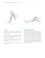 Preview for 68 page of Zimmer Biomet NexGen MIS LPS-Flex Surgical Technique Manual