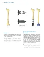 Preview for 6 page of Zimmer Biomet OSS Compress Surgical Technique Manual