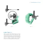 Preview for 13 page of Zimmer Biomet OSS Compress Surgical Technique Manual