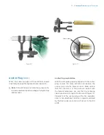 Preview for 17 page of Zimmer Biomet OSS Compress Surgical Technique Manual