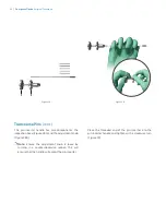 Preview for 24 page of Zimmer Biomet OSS Compress Surgical Technique Manual