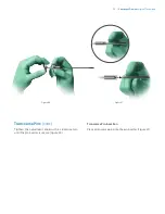 Preview for 25 page of Zimmer Biomet OSS Compress Surgical Technique Manual