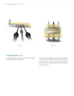 Preview for 26 page of Zimmer Biomet OSS Compress Surgical Technique Manual