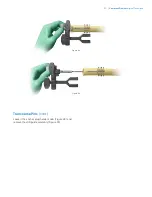 Preview for 29 page of Zimmer Biomet OSS Compress Surgical Technique Manual