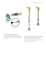 Preview for 49 page of Zimmer Biomet OSS Compress Surgical Technique Manual