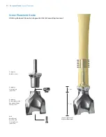 Preview for 50 page of Zimmer Biomet OSS Compress Surgical Technique Manual