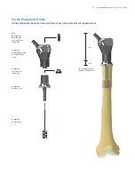 Preview for 53 page of Zimmer Biomet OSS Compress Surgical Technique Manual