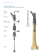 Preview for 54 page of Zimmer Biomet OSS Compress Surgical Technique Manual