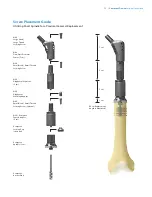 Preview for 55 page of Zimmer Biomet OSS Compress Surgical Technique Manual