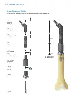 Preview for 56 page of Zimmer Biomet OSS Compress Surgical Technique Manual