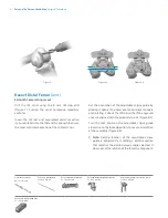 Preview for 10 page of Zimmer Biomet Persona Manual